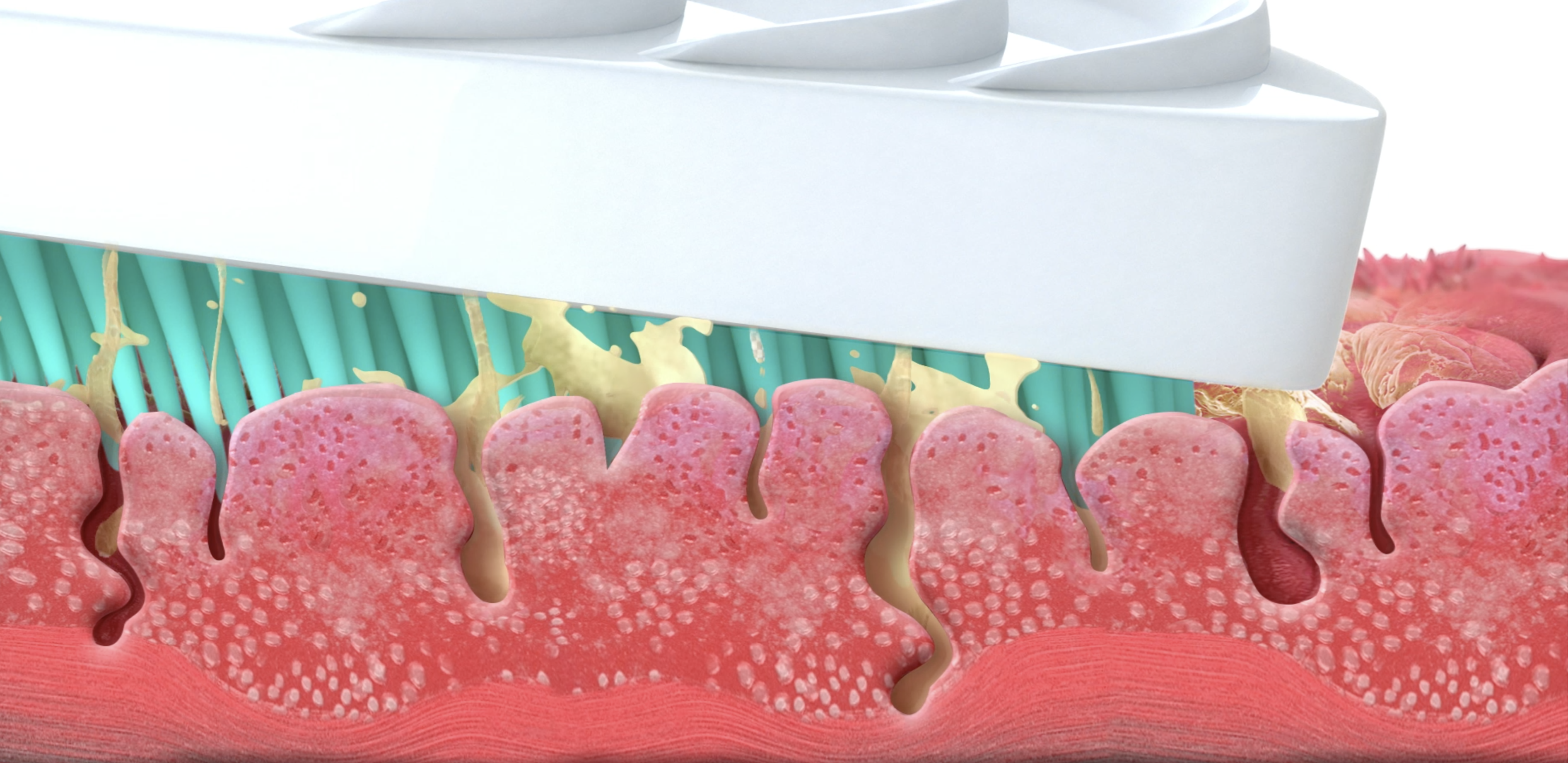  Raschietto lingua: verità o mito? I migliori strumenti per una lingua pulita